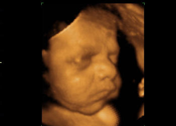 Missouri Republicans Want Amendment Confirming There’s No Right to Abortion