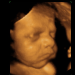 Missouri Republicans Want Amendment Confirming There’s No Right to Abortion