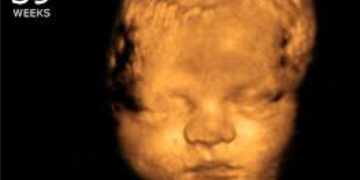 New York Fails to Pass Bill Creating “Right” to Kill Babies in Abortions
