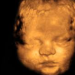 New York Fails to Pass Bill Creating “Right” to Kill Babies in Abortions