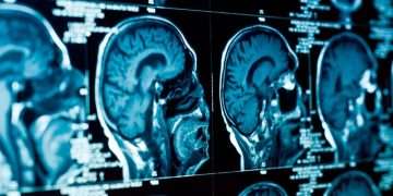 Covid Vaccine Prion Disease