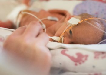 Doctors give premature baby a tiny pacemaker in a groundbreaking surgery