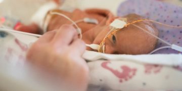 Doctors give premature baby a tiny pacemaker in a groundbreaking surgery