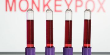 WHO to decide whether to elevate monkeypox to 'public health emergency of international concern'