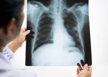 WHO is now monitoring cases of pneumonia of “unknown origin”