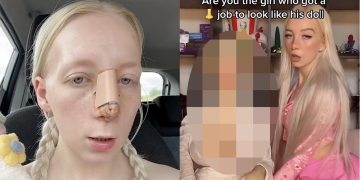 Influencer spends $11k for plastic surgery to look like boyfriend's sex doll because that's the world we live in