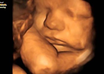 They Use Euphemisms Like “Fetus” and “Pro-Choice” Because They Can’t Admit Abortion Kills Babies