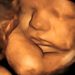 They Use Euphemisms Like “Fetus” and “Pro-Choice” Because They Can’t Admit Abortion Kills Babies