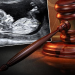 South Carolina Supreme Court Just Issued a Horrible State Version of Roe v. Wade