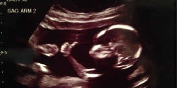 13 Pro-Life Groups Send Letter Telling Walgreen and CVS: Stop Selling Abortion Pills