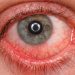 COVID Vaccines Linked to Untreatable Eyeball Clots, Reveals Massive Study.