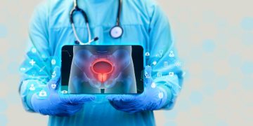 Prostate Cancer