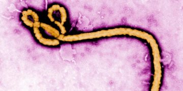 Ebola